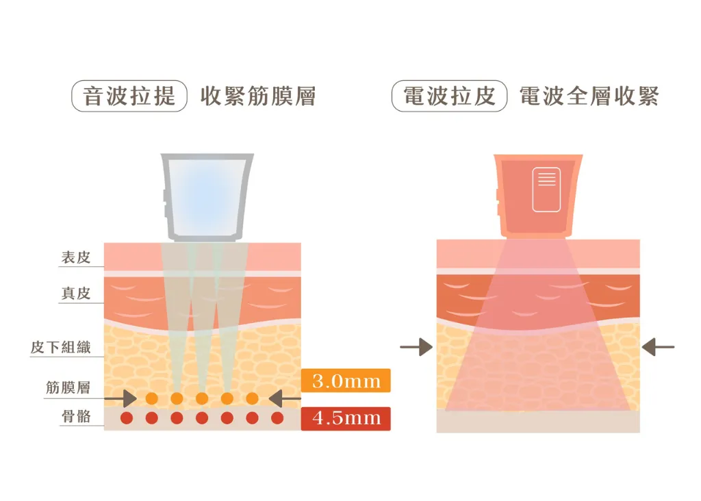 最完整音波電波差異比較指南！一篇搞懂原理與功效