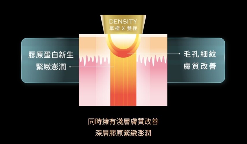 無雙電波（DENSITY）特色