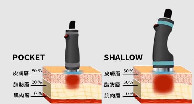 針對皮下脂肪層的加熱設計